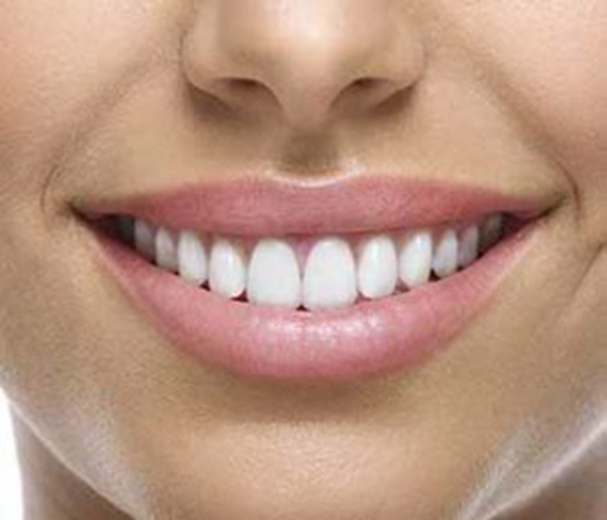 World’s First BPA-free restorative/filling material
