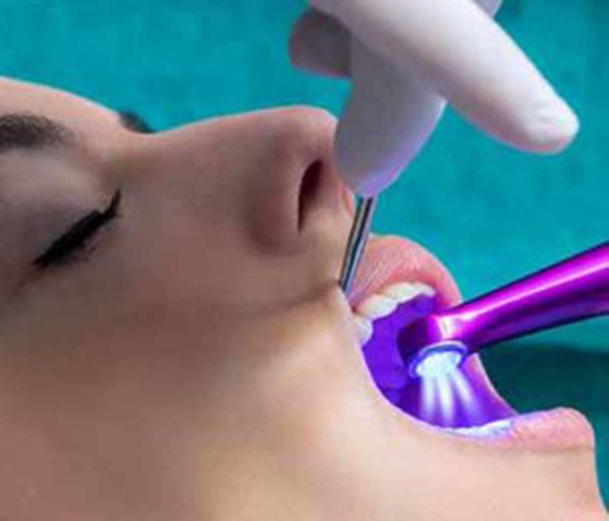 Ozone therapy from Maine Center for Dental Medicine is a dentistry treatment that eliminates harmful oral bacteria to restore health