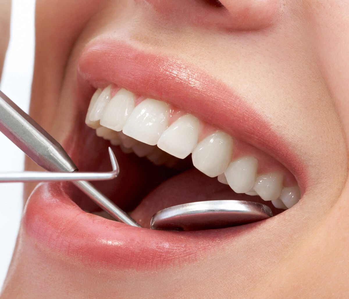 What Are the Benefits of Laser Dentistry Services from a Dental Professional in Skowhegan Area?