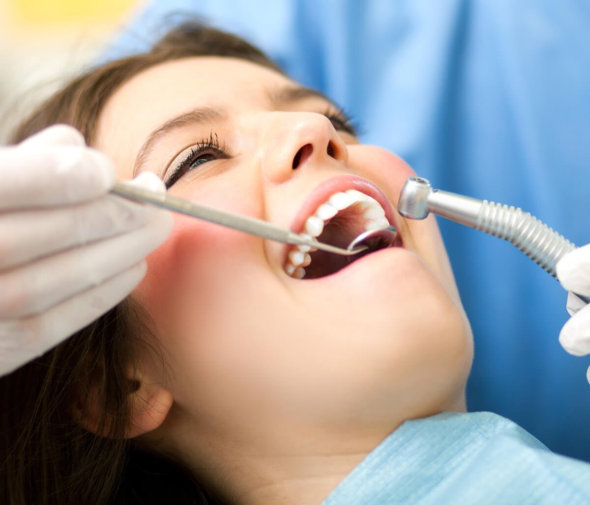 Tooth Implant Options in Skowhegan ME Area