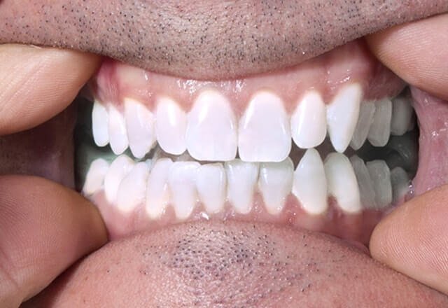 http://After%20Image%20Case%201