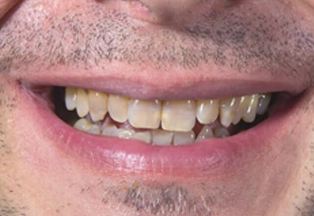 http://Before%20Image%20Case%209