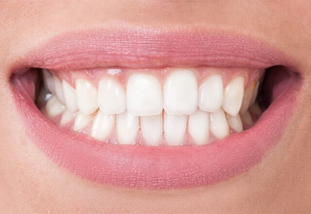 http://After%20Image%20Case%2012