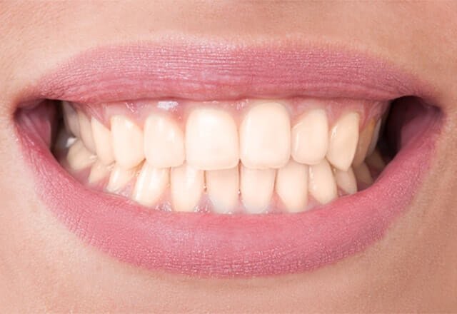 http://Before%20Image%20Case%2012