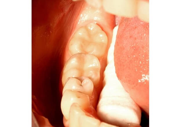 http://After%20Image%20Case%201