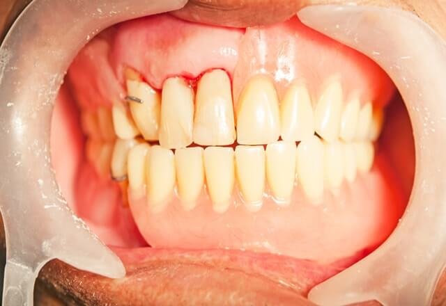http://After%20Image%20Case%202
