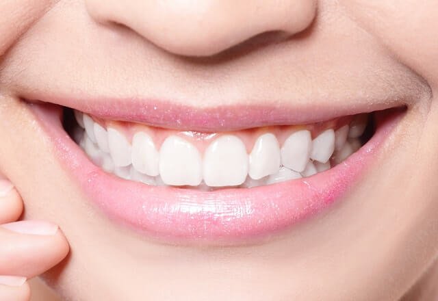 http://After%20Image%20Case%205