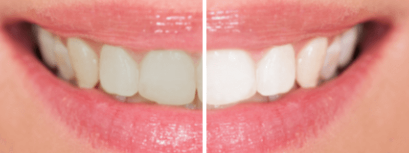 Cosmetic Dentistry Skowhegan ME - Cosmetic Dentistry